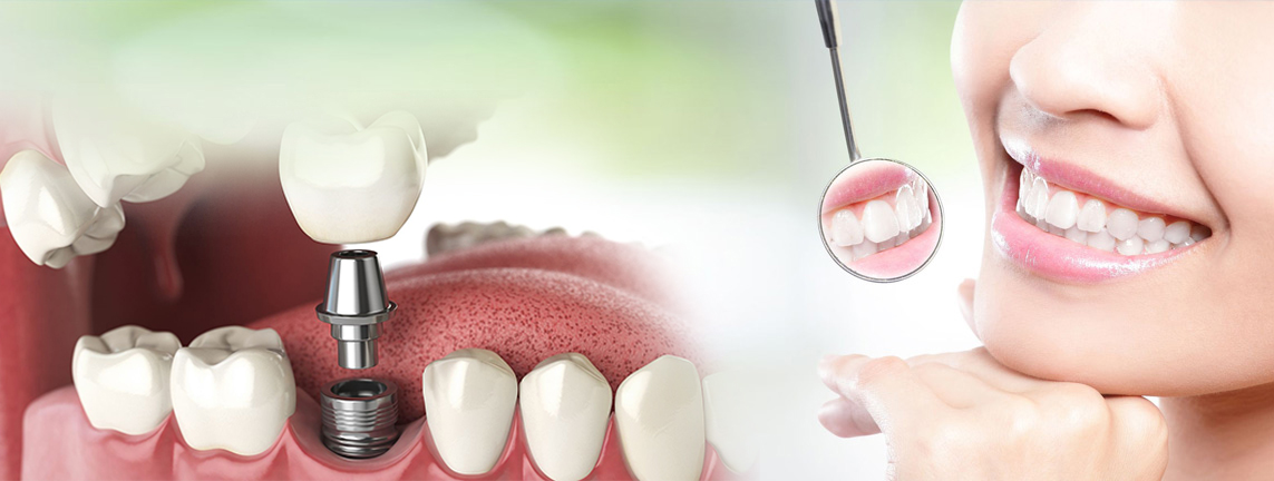 Dentist in Ranchi